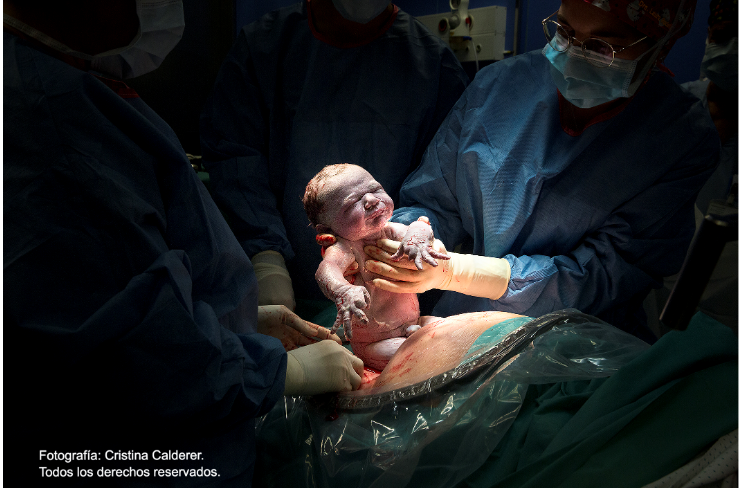 Parto velado  La impresionante imagen de una cesárea velada en el Hospital  de Vinaròs